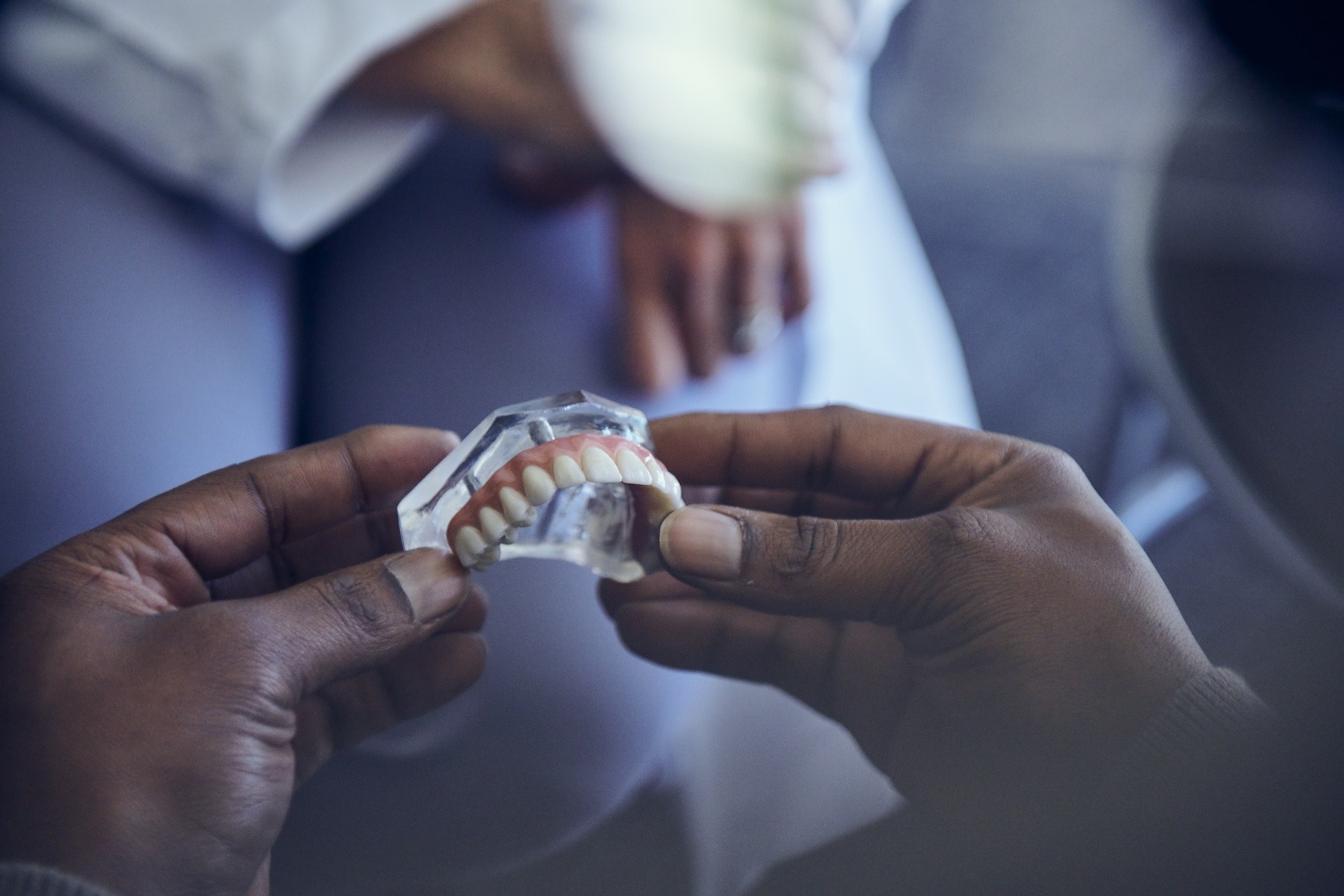 What is a Full Set of Dental Implants